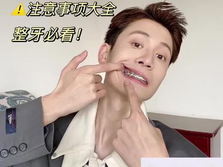 整牙人必看!打骨钉的注意事项们!#牙齿矫正 #正畸 #牙套