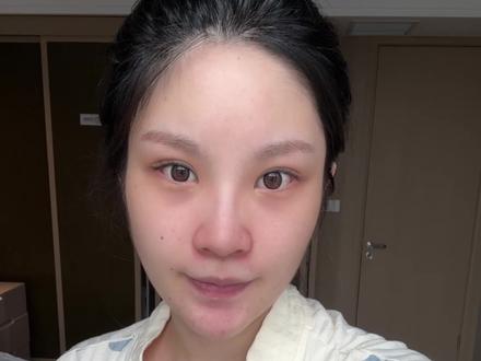 来啦来啦!姐妹们关心的费用和痛感问题!!#怀孕 #剖腹产 #腹膜外剖宫产 #新生儿 #产后宝妈