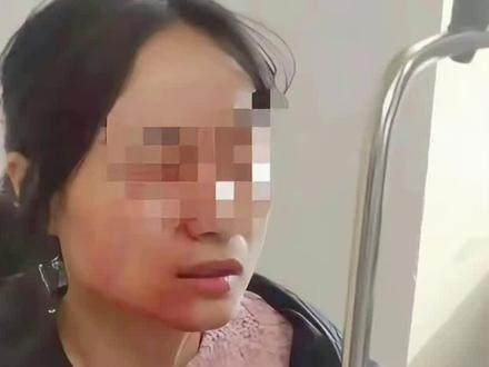 镊子刺穿眼球,谁来保护战战兢兢的老师? 浙江瑞安14岁女生因被劝架怀恨在心,用镊子扎穿执教17年的宋老师眼球致其重伤,却因未成年身份未被处罚,仅获2万赔偿,这起极端的校园悲剧无情撕开了法律滞后、教师失保与家长傲慢的三重遮羞布。
#校园暴力 #教师权益 #社会热点 #真实案例 #未成年人保护法