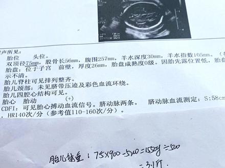 30周宝宝3.1斤达标了没?也不知道偏小没,姐妹们你们的宝宝多重?#孕晚期 #二胎 #孕检 #宝宝体重 #卸货倒计时
