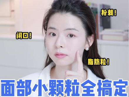 一次解决脂肪粒!闭口!毛周角化!粉刺!#护肤 #闭口粉刺 #毛周角化 #脂肪粒 #去闭口好物推荐 #怎么才能去闭口
