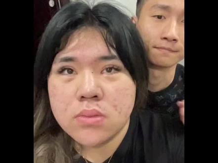 #珍妮佛梓 被打有谁知道的吗?可以告诉我事情是怎样的吗?#p图前后