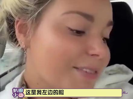 #为什么左脸会比右脸更好看 快来看看从医学角度出发,为什么左脸更好看吧