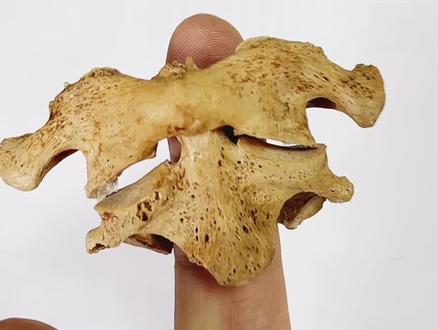 寰枢椎的日常,基本解剖结构#寰枢关节