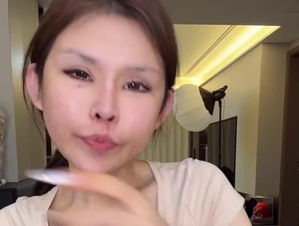 #珍妮佛梓 珍妮佛整容项目大揭秘