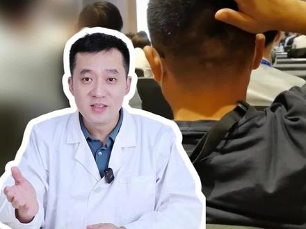 经常抠头皮真的会变秃头!头皮经常出油长头屑的试试这个方法#煤焦油洗剂 #脂溢性皮炎 #头油 #头屑 #科普