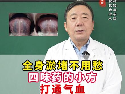 全身淤堵不用愁,四味药的小方,打通气血,舌底青筋慢慢消 #淤堵 #补气血 #中医舌诊