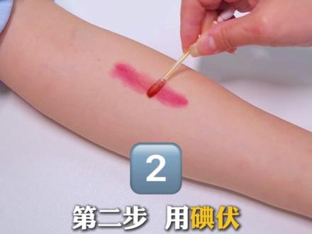 不想身上留下难看的疤痕,一定要记住受伤后的正确处理方法。 #伤口处理 #疤痕 #科普 #颜值 #韩老爸的生活处方