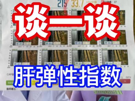 肝弹性测定,近年来流行的肝硬度测定方法。数值简单易懂。但是提供的信息单一,并不能作为评判病情的标准。
#肝硬化 #肝弹性指数 #医学科普