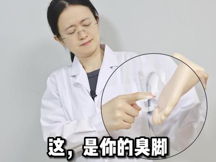 #脚臭 不一定是#脚气 ,看看你的脚有没有我说的这些问题!#细菌感染 #科普
