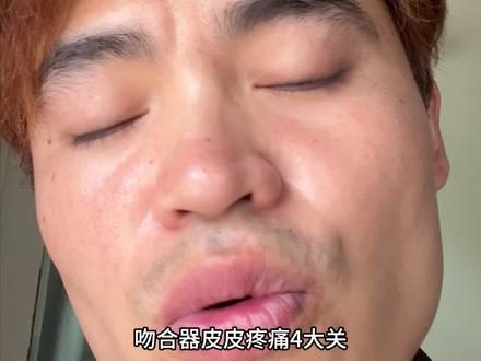 吻合器疼痛4大关 真实分享#真实记录#割包皮#套路#男性
