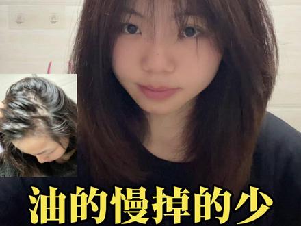 夏季学会详细的养发方法✅控油少掉 #洗头 #养发护发 #控油蓬松 #掉发