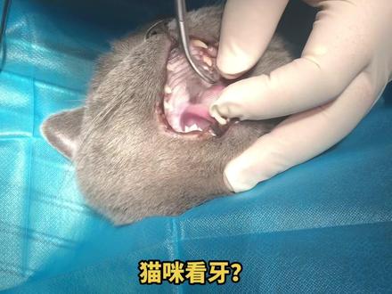 猫咪牙科,猫拔牙见过吗?宠物牙结石是最容易被宠物主人忽略的健康问题,牙结石会导致牙龈发炎,增生,红肿,最后牙齿松动,疼痛,无法进食,这只英短只有6岁,牙齿松动两颗,不敢吃硬的,每天郁郁寡欢,这种情况必须是拔牙了,坏掉的牙齿没法长回去,拔牙后影响不会很大,只要牙不疼,就能正常吃饭。#猫拔牙#宠物牙科#科学养宠