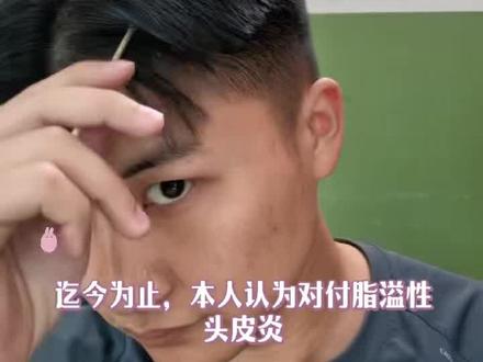 低成本教你淡化纸易性皮焱#生发#脱发#脂溢性脱发