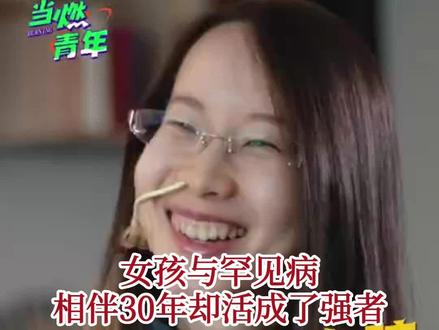 #女孩与罕见病相伴30年却活成了强者 刘开心与罕见病EDS相处了30年,“每天都在把自己打碎重组”。#罕见病女孩已六七年没吃过饭 ,只能靠鼻饲提供营养;她的心脏要靠起搏器跳动,因为身体过敏,甚至不能流太多眼泪。但别人眼中的她,始终“开心”:她下厨、美甲、讲脱口秀,用插满针管的手敲出毕业论文,还办了画展。她说:我向来都在强者之列,这具不由我控制的躯体,也不曾禁锢我。加油,开心!