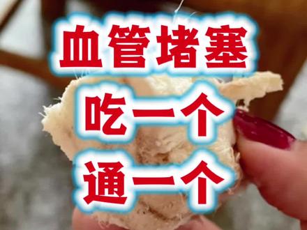 血管瘀堵的朋友,葛根搭配两味药,不知道太可惜了