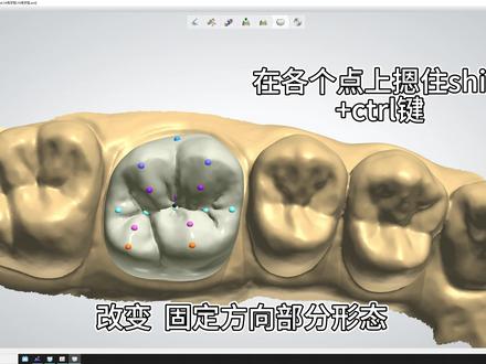 3shape设计软件入门级教学。#3shape #EXO #牙齿 #大连口腔义齿中等职业技术学校