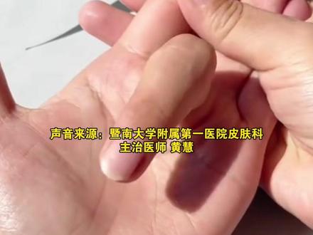 “#勾中指 ”竟然是个#养生 动作 中医:通则不痛 痛则不通 适合#熬夜 、脸色蜡黄、#肩颈不适 人群