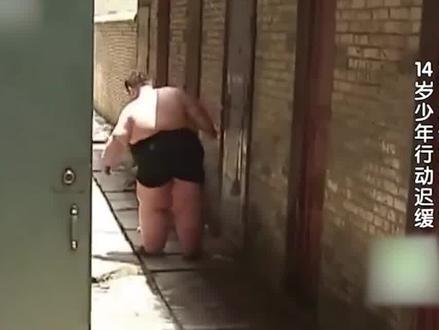 14岁男孩体重高达300斤,一顿吃18包泡面,如今已去世两年