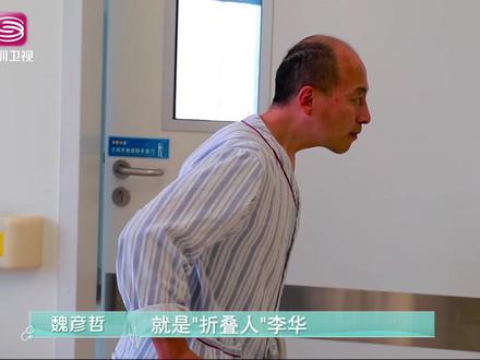 “折叠人”李华身体弯曲将近180度,“珠穆朗玛峰”级别的手术让他重新直立起来!堪称医学奇迹!深圳卫视每周五晚21:20 #我的白大褂 #脊柱 #强直性脊柱炎