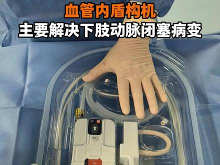血管内盾构机主要解决下肢动脉闭塞的病变,也需要我们医生评估条件#血管外科 #武汉协和医院王剑