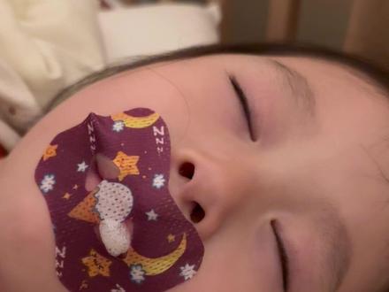 带3岁女儿做腺样体和扁桃体手术 她真的比想象中的坚强……#腺样体面容#孩子