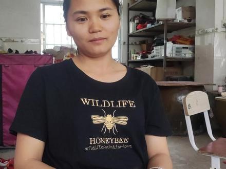 阿城焊不锈钢打住眼睛,想用母乳洗眼止疼,这下把晓梅难住了