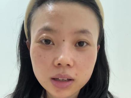 29岁一手好牌被自己打的西趴烂…… 人生每段感情都是经历 大大方方去失败 不在任何场合怯场 …#正畸的心路历程 #女性成长困惑交流 #女性成长困惑求助