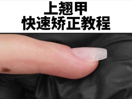 上翘甲简易快速矫正教程~
#零基础学美甲 #上翘甲矫正 #上翘甲贴片教程 #新手美甲教程 #贴甲片教程