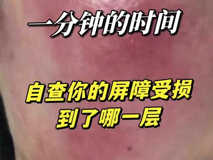 一分钟的时间教你自查你的屏障受损到哪一层呢?#屏障受损#增厚角质层修复红血丝 #玫瑰脸修复 #问题性皮肤管理 #感谢抖音感谢抖音平台