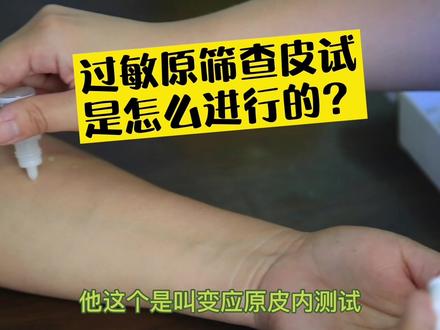变应原皮内测试怎么做?痛吗?#全民健康计划 #健康真相官