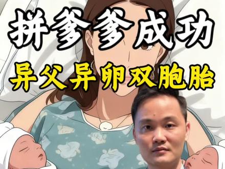 巴西女子产下异父异卵双胞胎 #吃瓜群众 #内容过于真实