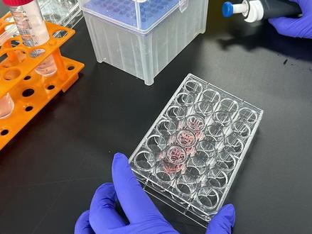 科研干货 | Transwell迁移实验🧪操作全过程 欢迎有实验操作困扰的同学私信苏苏哦~
手把手实操指导,带你系统性建立规范的实验操作体系。
#细胞实验 #生物实验 #科研日常 #transwell #实验外包