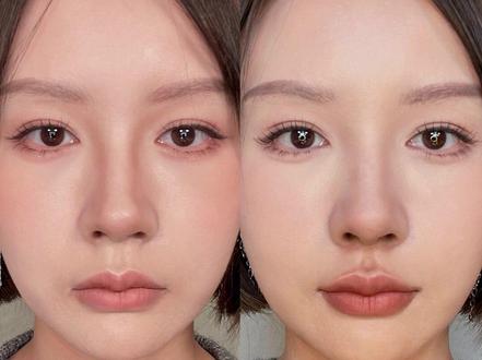 不用整X也能缩短人中年轻十岁不是梦啊!#人中缩短 @抖音小助手