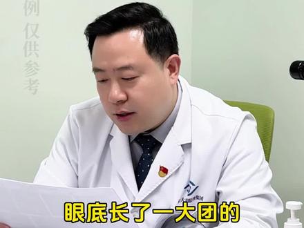 老人视物变形扭曲、中心发暗别再以为是老花眼了❗️可能是老年黄斑变性找上门了⚠️别等看不见了再后悔!那它能治好吗?一条视频告诉你答案!
#门诊日常 #老年黄斑变性 #眼底病 #新生血管