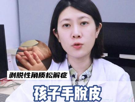 换季孩子手脱皮,家长可以这样处理#剥脱性角质松解症#医学科普#皮肤