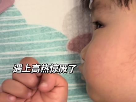 弟弟第一次高热惊厥,我慌但没乱手脚 弟弟发烧时第一次出现高热惊厥,现在想起来还心有余悸。当时我正喂妹妹喝奶,弟弟睡着突然大叫一声,我坐在外面看到他手举起来,赶紧放下妹妹冲过去——才发现他惊厥了。
当下我异常冷静,只知道不能乱动他,立刻帮他侧身。后来探鼻没感觉到呼吸,才叫老公抱起来轻轻拱着手拍拍背,怕有东西堵喉咙。大概1分钟后弟弟恢复过来,老公吓得抱着他不停喊名字。
我们赶紧收拾去医院,医生建议住院。当时看他吃了退烧药精神好转,就天真想回家跟家人商量,结果晚饭吃完又发作一次,直接住院了。
孩子发烧真的不能大意!第二天医生检查才发现喉咙有疱疹,照CT排除了脑炎,这几天就能出院了。
#高热惊厥抽搐 #宝宝发烧抽搐