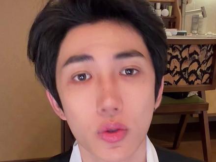 植发只是种树,还要记得养好根 #变美#非那雄胺#植发