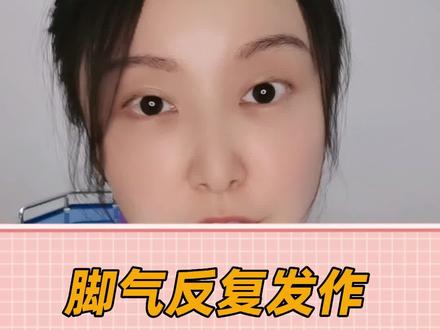 #脚气 反复发作,可能是你用药的方法不对#特比萘芬喷雾