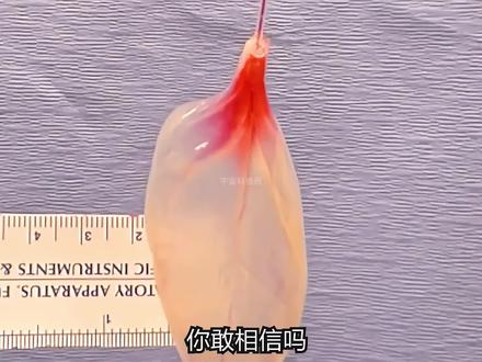 用菠菜造出人体心脏,科学家是怎么做到的?未来器官或来自植物? #科普知识 #菠菜 #心脏 #生命科学 #涨知识