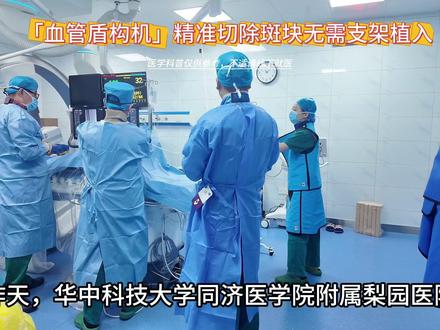 「血管盾构机」精准切除抽吸斑块和血栓,避免永久支架的植入 武汉梨园医院创面修复血管外科采用新斑块旋切器械为血管堵塞的患者进行疏通,这是一款具有主动抽吸和灌注功能的兼容器械,详细操作可以看视频讲解,该技术非常适合年纪较轻和不想在体内放支架的血管堵塞的患者。#血管堵塞 #介入 #疏通血管 #抖出健康知识宝藏