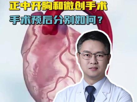 正中开胸和微创手术,手术预后分别如何? #心脏手术 #中老年健康 #抖出健康知识宝藏