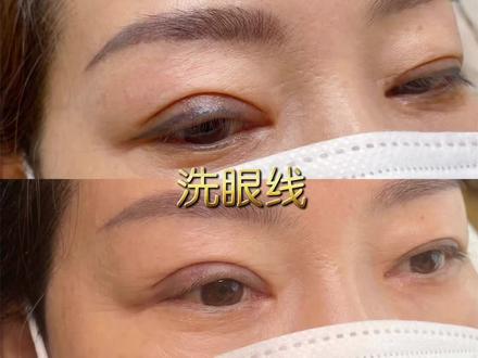 祛除老式眼线很难吗?用对方法祛除颜色次数少、效果好#洗眼线