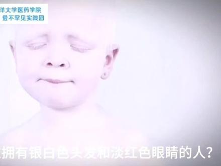 【为“罕”呐喊 爱不罕见|3、走近白化病:揭开白化病的神秘面纱】
你知道吗,有一种疾病,让患者的世界仿佛被蒙上了一层薄纱,他们的皮肤白皙如雪,毛发淡若银霜,眼睛在阳光下显得格外脆弱,这就是白化病。
作为被列入国家《第一批罕见病目录》的疾病,白化病属于遗传性疾病,由基因突变导致黑色素合成障碍。患者皮肤、毛发色素减退,眼部也会出现如眼球震颤、视力低下、畏光等症状 。
中国海洋大学医药学院“为‘罕’呐喊,爱不罕见实践团”,一直致力于罕见病知识的科普宣传。我们希望通过努力,让更多人了解白化病,消除误解与偏见,给予患者尊重与关爱,让他们能在温暖与理解中勇敢生活。
#中国海洋大学 #药学 #罕见病科普视频