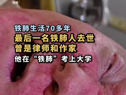近日,世上最后一名“铁肺人”保罗·亚历山大去世,享年78岁。因脊髓灰质炎,他被困“铁桶”70多年。随着医学进步,如今他的困境,仅需一枚糖丸解决。