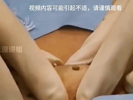 宝子们这期格外的饱满#护肤 #痘痘黑头粉刺拜拜 #细胞夹面部清理工具 #深层毛孔清洁 #解压