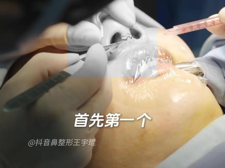 隆鼻的手术流程#成都隆鼻 #隆鼻手术 #科普一下