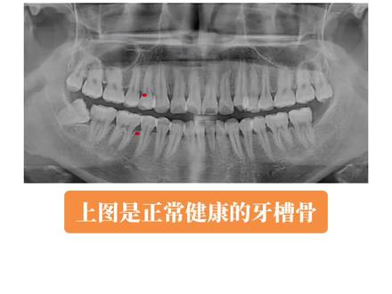 #口腔ct图片 #牙齿🦷 生活处处惊喜和惊吓🙀