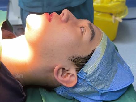 3D打印Peek下巴,打造男性硬朗轮廓感 #peek下巴 #帅哥 #型男 #假体下巴 #性张力