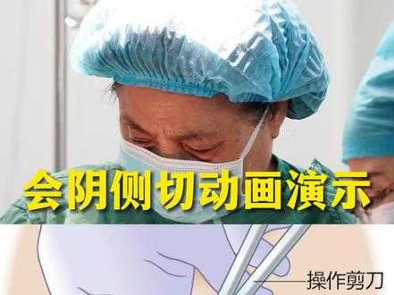 会阴侧切动画演示 #妇产科 #怀孕 #保胎